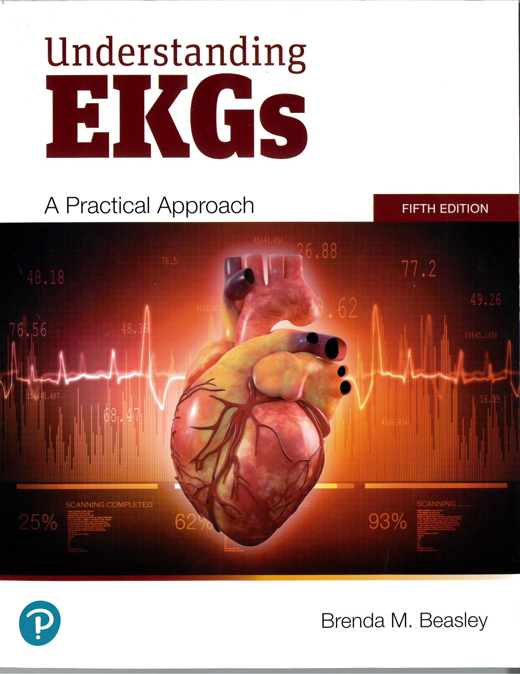 Understanding EKGs