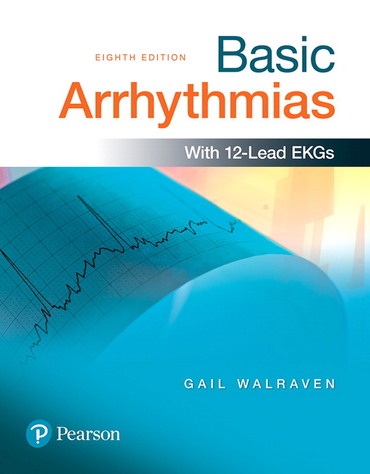 Basic Arrhythmias 8th edition